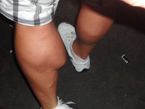 Leaked calves header onlyfans leaked
