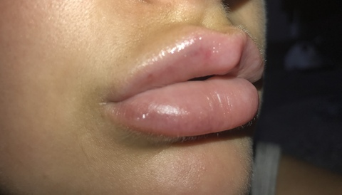 Leaked cherri-lee header onlyfans leaked