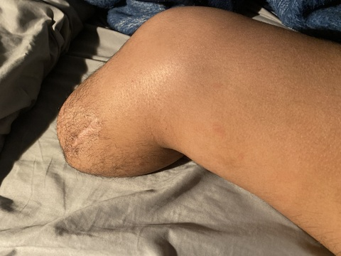 Leaked strongamputee header onlyfans leaked